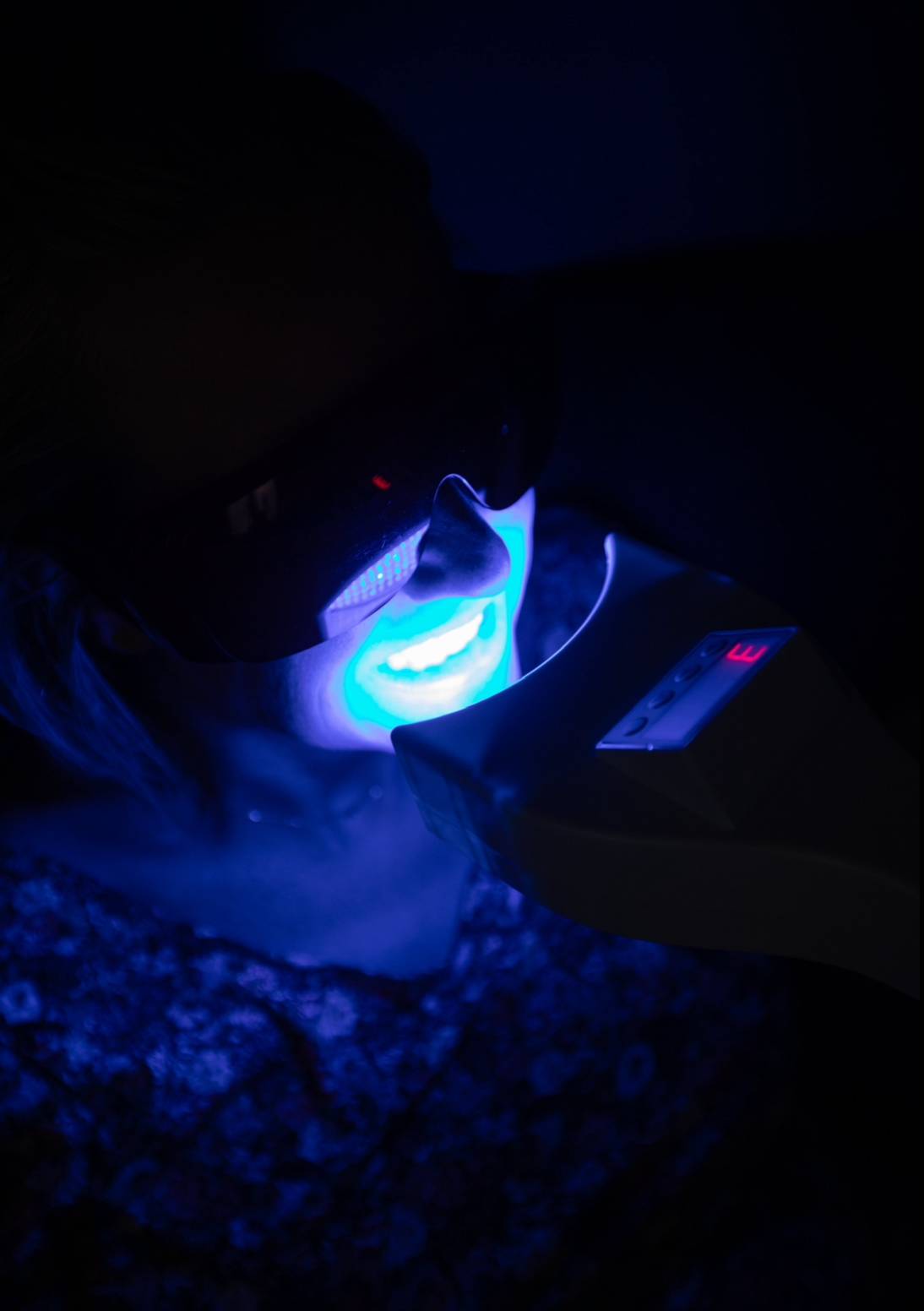 Faire un blanchiment dentaire sans danger à Marseille 13008