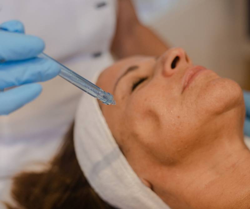 Je jet Peel pour un effet glowy immédiat à Marseille 13008