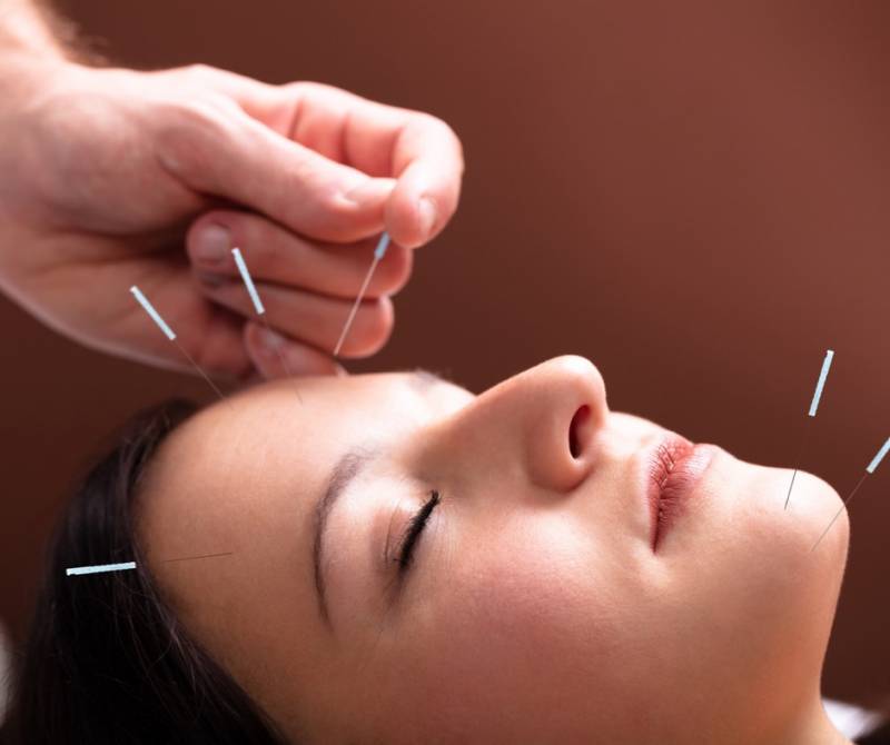 Nouveauté exclusive : le soin Aculifting, une technique ancestrale alliant acupuncture et massage énergétique chinois, arrive chez R’Pur Prado Marseille 13008