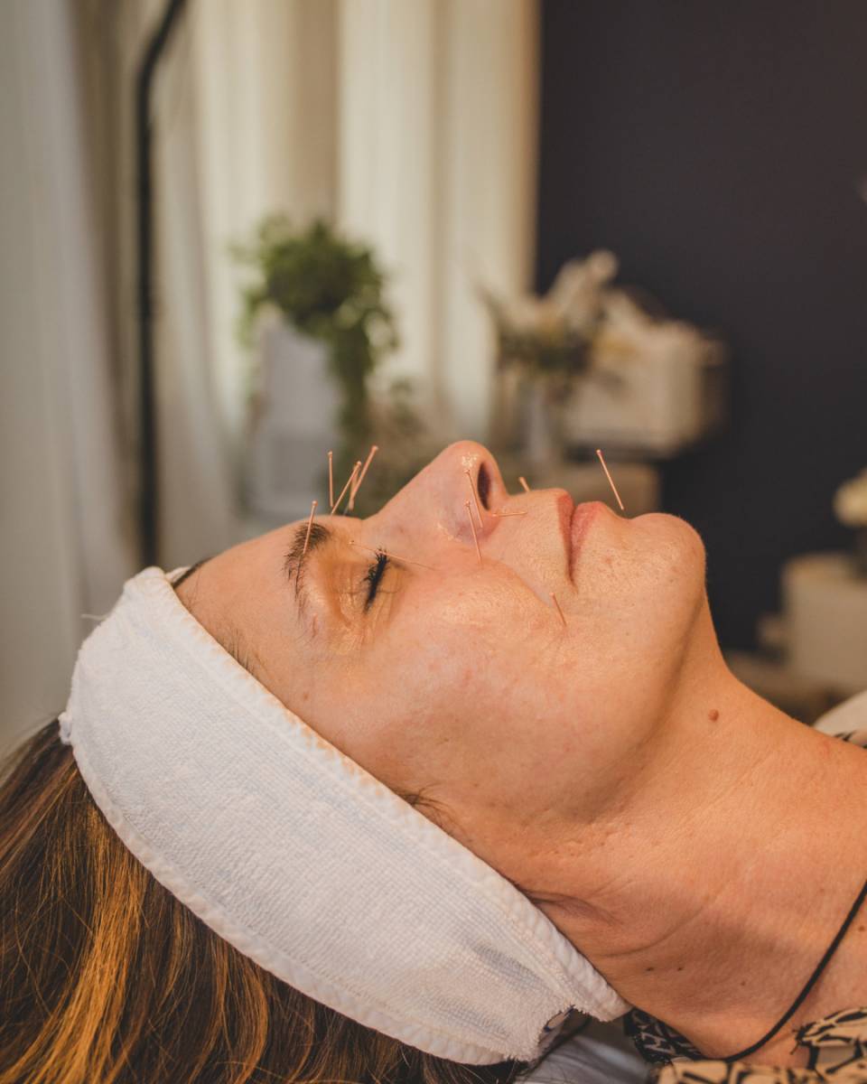 ACULIFT : MÉDECINE TRADITIONNELLE CHINOISE